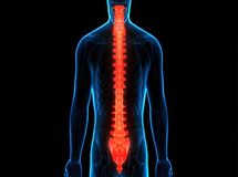 علائم سرطان نخاع چیست؟